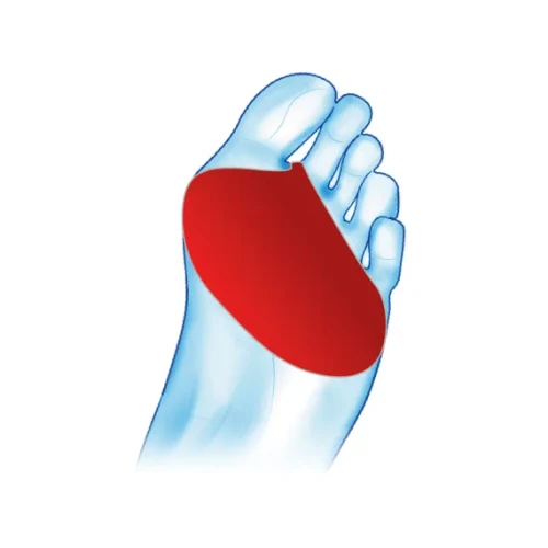 metatarsal-cover-zastosowanie-kopia.webp